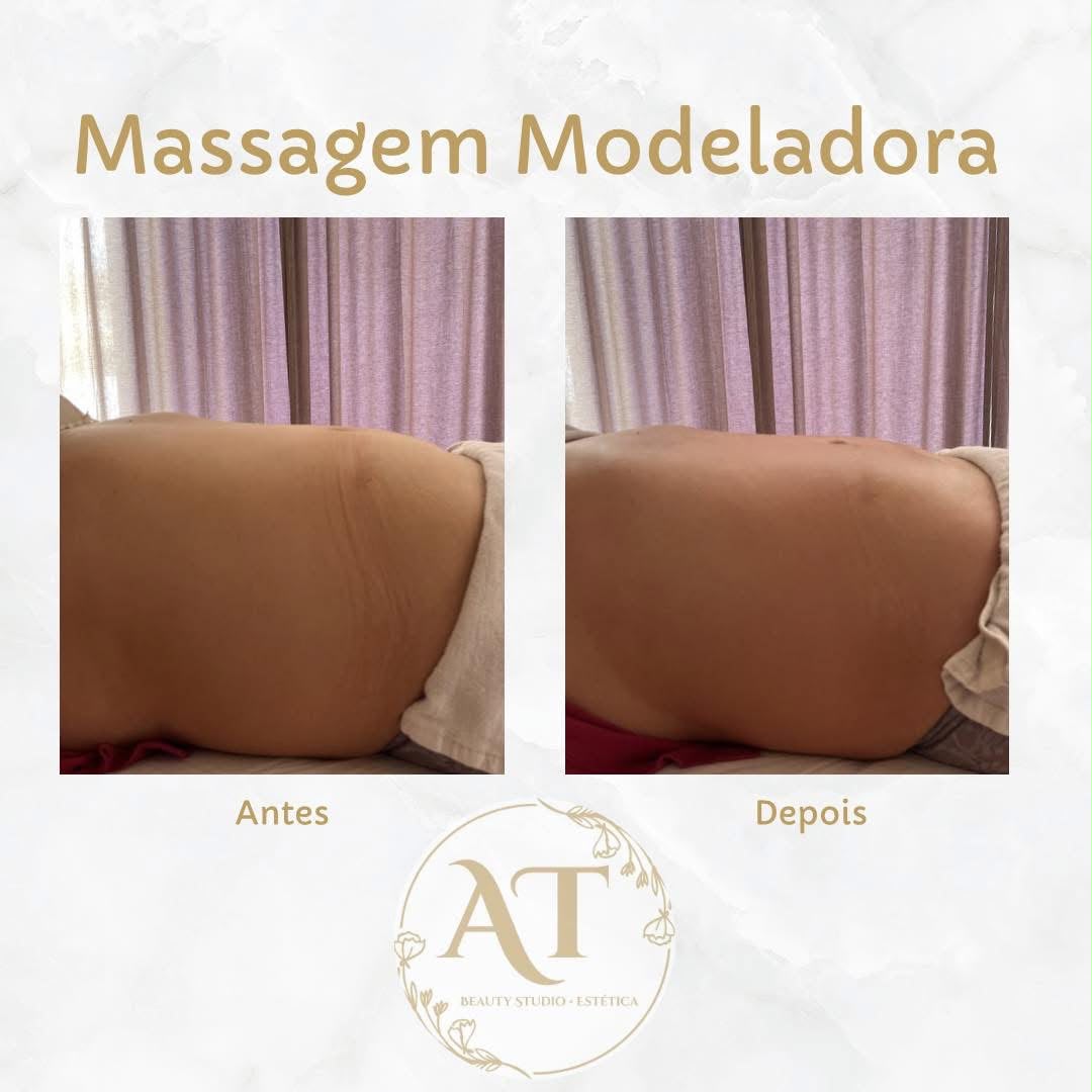 Massagem Modeladora